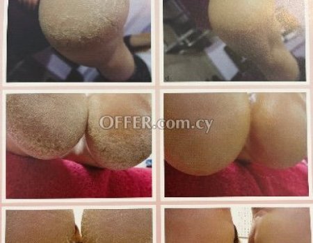 Τριπλη θεραπεία για τα πόδια για καθαρές και υγιές φτερνες - 2