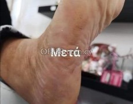 Τριπλη θεραπεία για τα πόδια για καθαρές και υγιές φτερνες - 6
