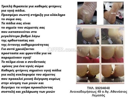 Τριπλη θεραπεία keratolytic για καθαρές φτερνες